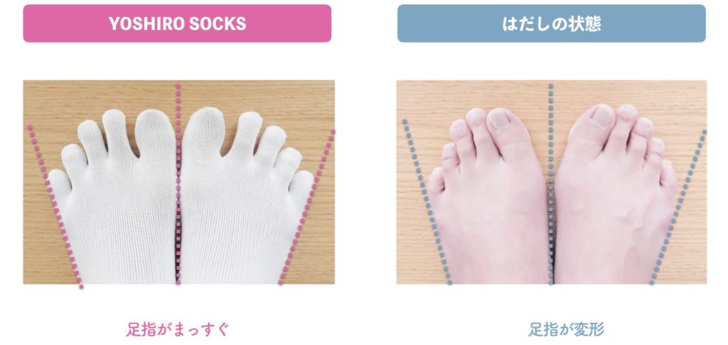 第8話 足指の変形をソックスで矯正 足指研究の第一人者 湯浅慶朗の公式サイト