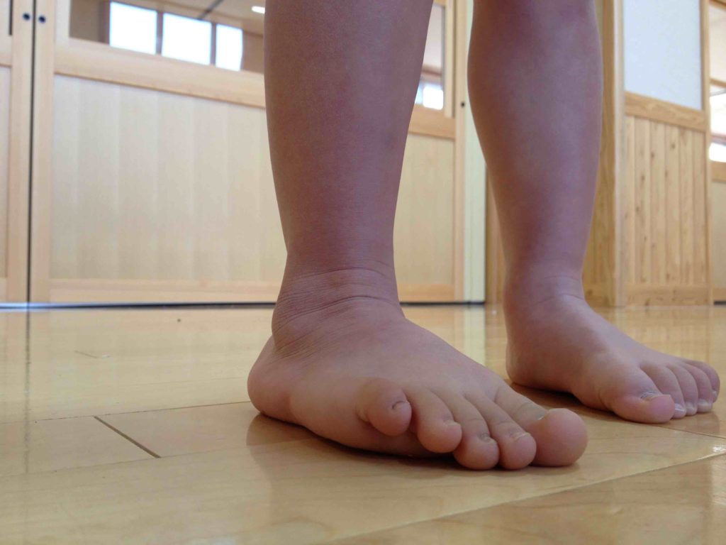 足指変形と運動能力の関連性に関する研究 ひろのば体操 オフィシャルサイト